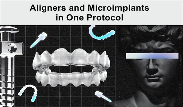 <font style="vertical-align: inherit;"><font style="vertical-align: inherit;">
	
	Aligneurs et microimplants dans un seul protocole
	</font></font>