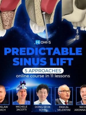 <font style="vertical-align: inherit;"><font style="vertical-align: inherit;">
	
	Cours prévisible de lifting des sinus
	</font></font>