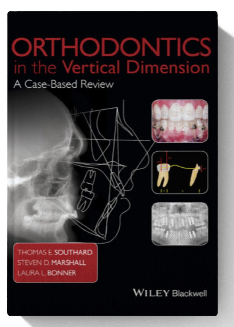 <font style="vertical-align: inherit;"><font style="vertical-align: inherit;">
	
	Orthodontie dans la dimension verticale&nbsp;: une étude de cas 1re édition
	</font></font>
