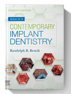 <font style="vertical-align: inherit;"><font style="vertical-align: inherit;">
	
	Livre électronique sur la dentisterie implantaire contemporaine de Misch, 4e édition
	</font></font>