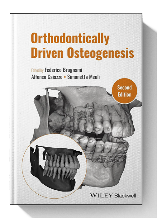 <font style="vertical-align: inherit;"><font style="vertical-align: inherit;">
	
	Ostéogenèse guidée par l'orthodontie 2e édition
	</font></font>